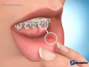 Mantenimineto E Higiene Brackets En Colmenar Viejo